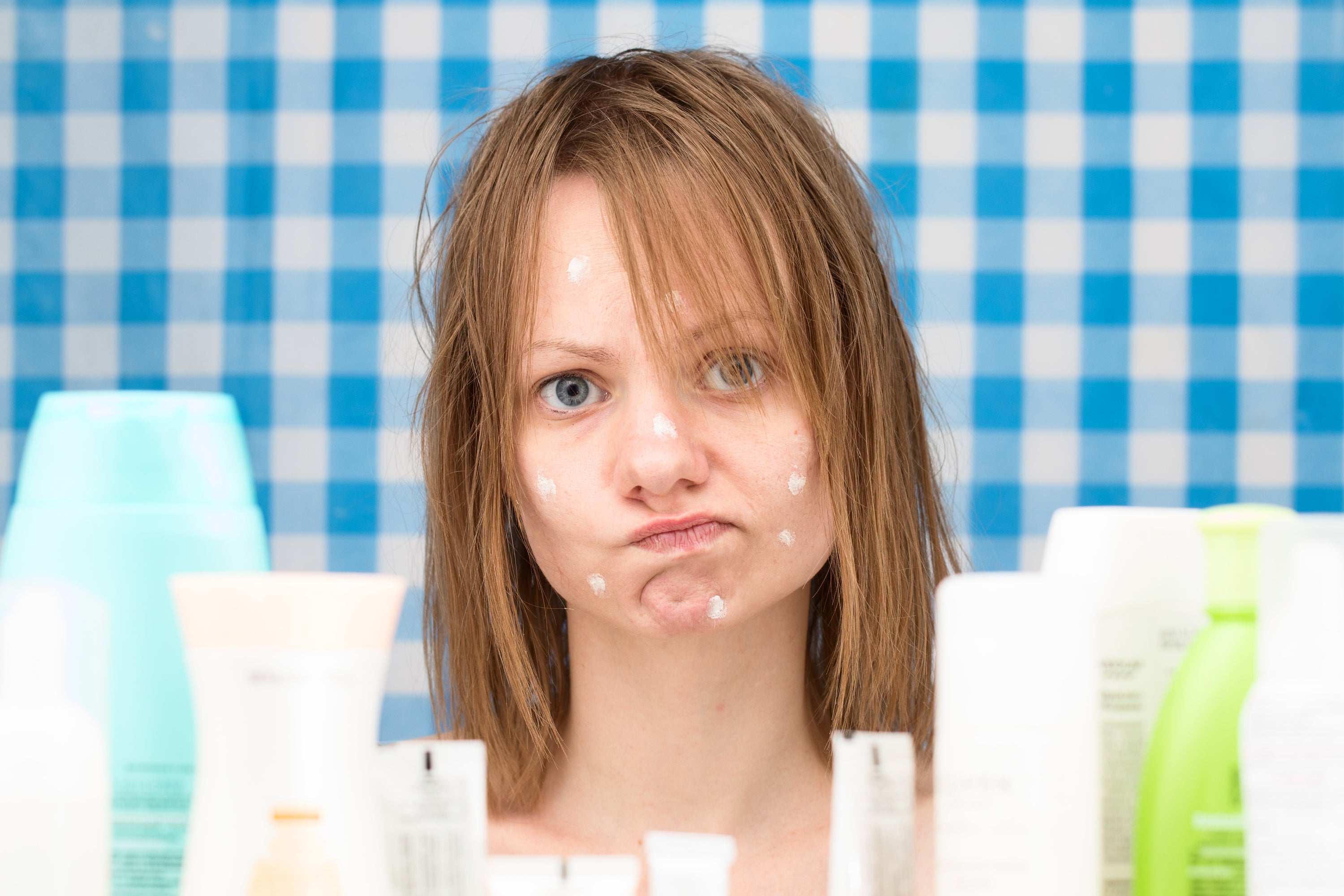 Are There Natural Acne Treatments That Really Work?