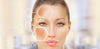 Getting Rid of Your Dark Skin Spots - Safely